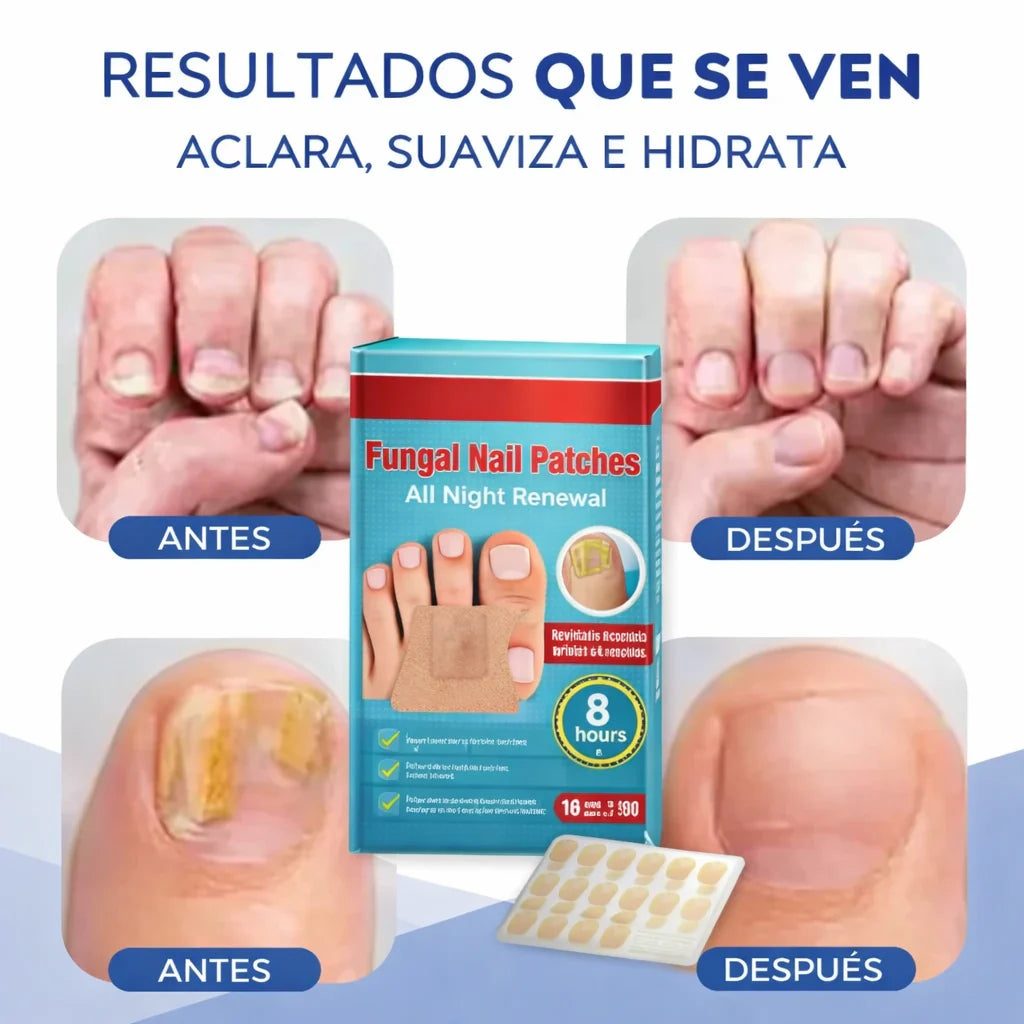PARCHE DE HONGO - 2x1 ( 32 Parches)